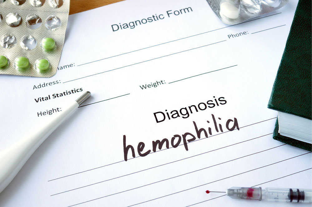 Hemophilia – Symptoms, Types, and Management Options