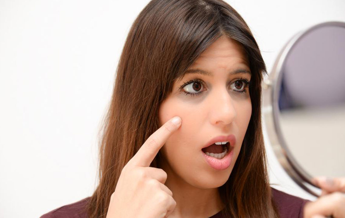 Here’s How to Fix Your Dark Circles Like a Pro